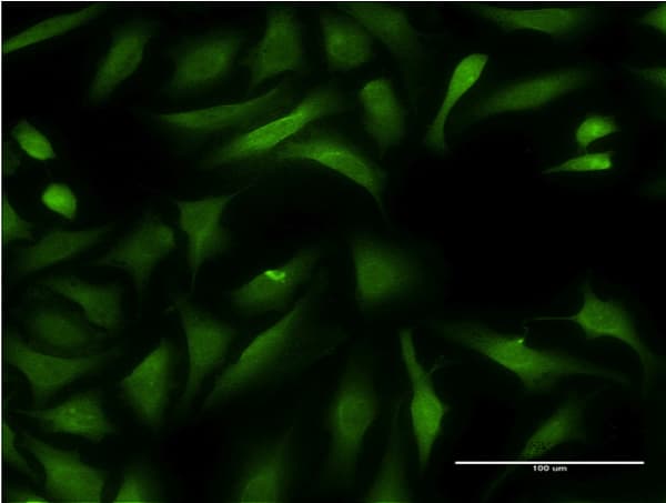 IHC-plus™ CCBL1 Antibody (clone 1B12)