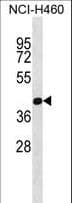 PRMT6 Antibody (aa19-48)