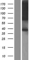 TRAM1 Protein (Over-Expression Lysate Myc-DDK (Flag))