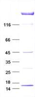 Human MKI67 / Ki67 Protein (Recombinant DDK,C-terminus)