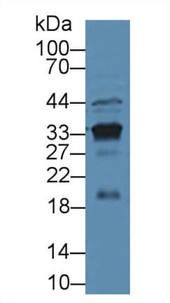 KLK3 / PSA Antibody (aa39-261, APC, Cy7)