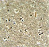 WDR82 / TMEM113 Antibody (aa1-30)