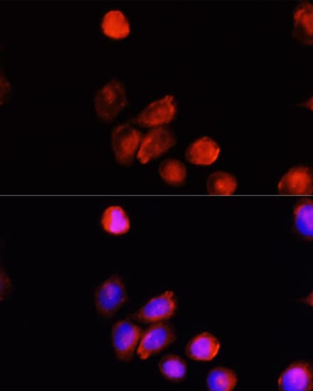 Tyrosinase Antibody
