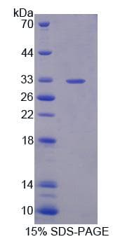 Human EPHA10 / EPH Receptor A10 Protein (Recombinant His-T7)