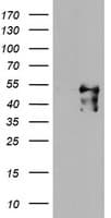 MEIS3 Antibody (aa1-261, clone OTI2D9, Carrier-free)