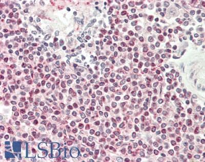 IHC-plus™ EIF4E Antibody
