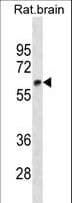 Monoclonal Mouse anti-Human GAD65 Antibody (aa445-473, WB)