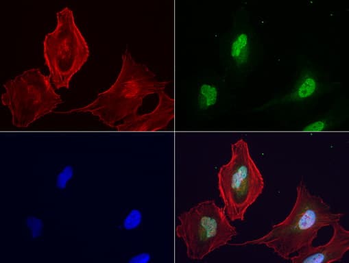 Monoclonal Mouse anti-Human LGALS3 / Galectin 3 Antibody (clone UMAB157, IHC, IF, WB)
