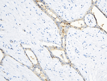 ANXA3 / Annexin A3 Antibody