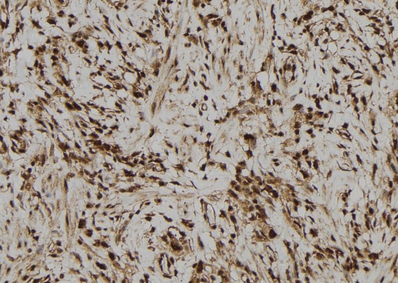IFI44 Antibody