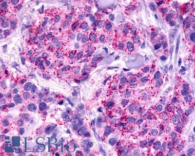PathPlus™ Polyclonal Rabbit anti-Human FKSG80 / GPR81 Antibody (C-Terminus, IHC)