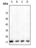 Polyclonal Rabbit anti-Human CTSH / Cathepsin H Antibody (WB)