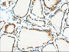 BDH2 Antibody (clone OTI3G10, Carrier-free)
