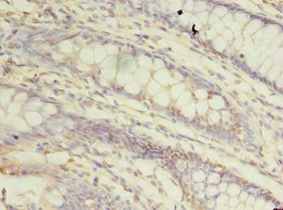 Polyclonal Rabbit anti-Human TRAPPC3 Antibody (IHC)