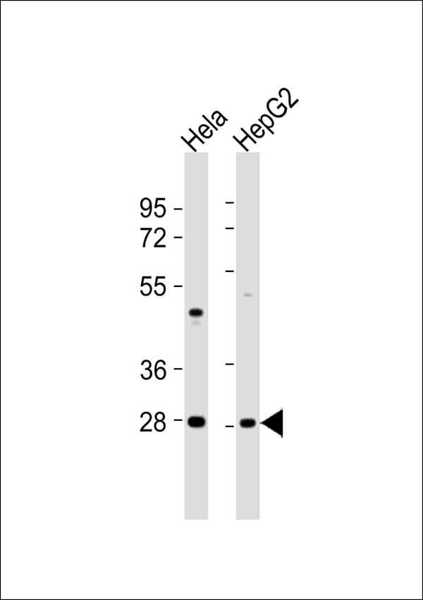 MPZ / P0 Antibody