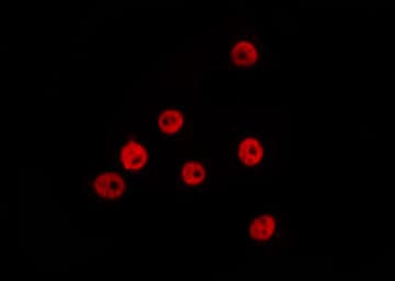 ZEB1 / AREB6 Antibody