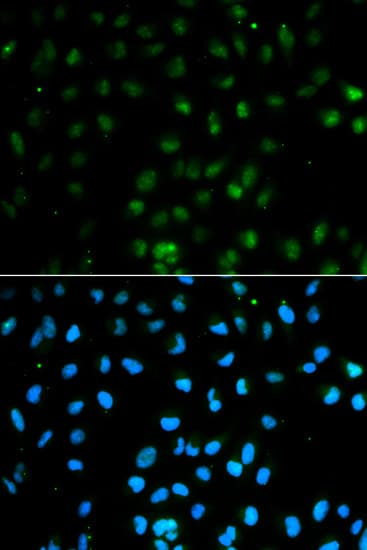 PTPN2 / TC-PTP Antibody
