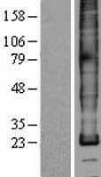 Human PLP1 / Myelin PLP Protein (Over-Expression Lysate Myc-DDK (Flag))