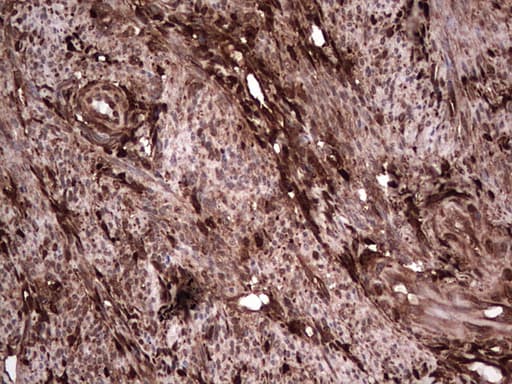 LGALS3 / Galectin 3 Antibody (clone OTI6E1)