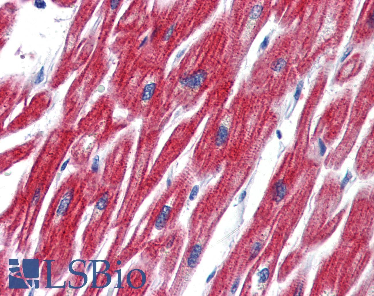 IHC-plus™ Polyclonal Rabbit anti-Human OLFM4 / Olfactomedin 4 Antibody (Internal)