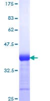 Human NOTCH3 Protein (Recombinant GST, N-terminus)
