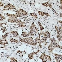 Polyclonal Rabbit Acetyl-Lysine Antibody (IHC, WB)