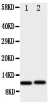 CXCL1 / GRO Alpha Antibody (aa99-107)