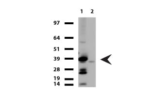 TNNT2 / CTNT Antibody (clone UMAB205, Carrier-free)