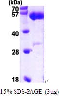 Human ALDH5A1 Protein (Recombinant His)