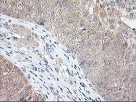 ALS2CR1 / NIF3L1 Antibody (clone OTI2B7)