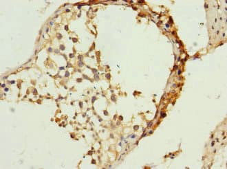 TIM23 Antibody