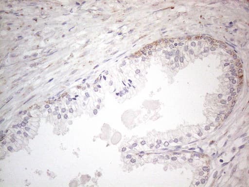 Monoclonal Mouse anti-Human BP1 / DLX4 Antibody (clone OTI8A1, IHC, WB)