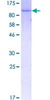 Human MPP3 Protein (Recombinant GST)
