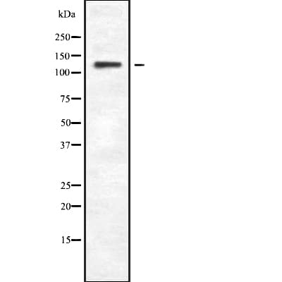 Polyclonal Rabbit anti-Human PLCB4 Antibody (WB)