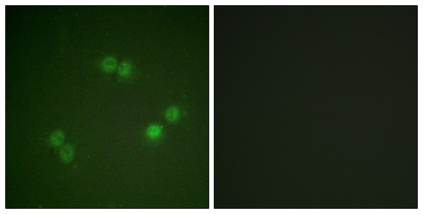 SF1 Antibody (phospho-Ser82)