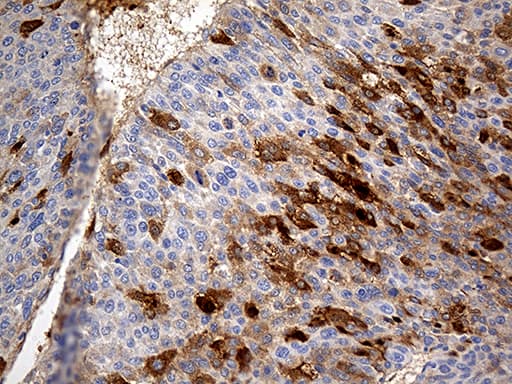 AZGP1 / ZAG Antibody (aa21-298, clone OTI2H3)
