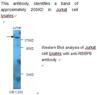 Polyclonal Rabbit anti-Human RBBP6 Antibody (WB)