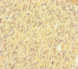 Polyclonal Rabbit anti-Human HIST1H2AB Antibody (IHC)