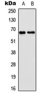 IHC-plus™ Polyclonal Rabbit anti-Human EPN2 Antibody (Internal, IHC, WB)
