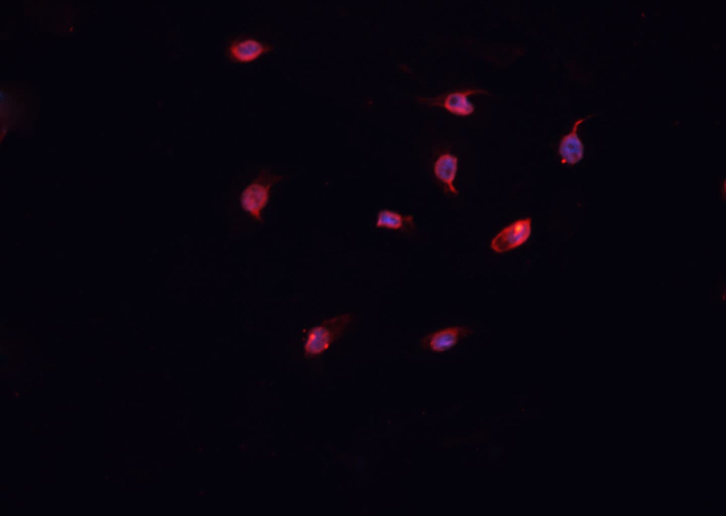 Collagen XII Alpha 1 Antibody