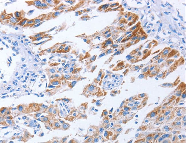 KIF3A Antibody