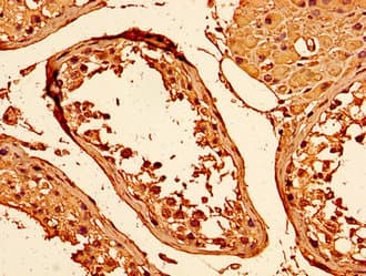 HIST1H1C Antibody