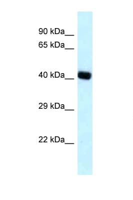 Polyclonal Rabbit anti-Human BCAT2 Antibody (aa23-72, WB)