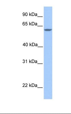 Polyclonal Rabbit anti-Human MTL5 / TESMIN Antibody (aa51-100, IHC, WB)