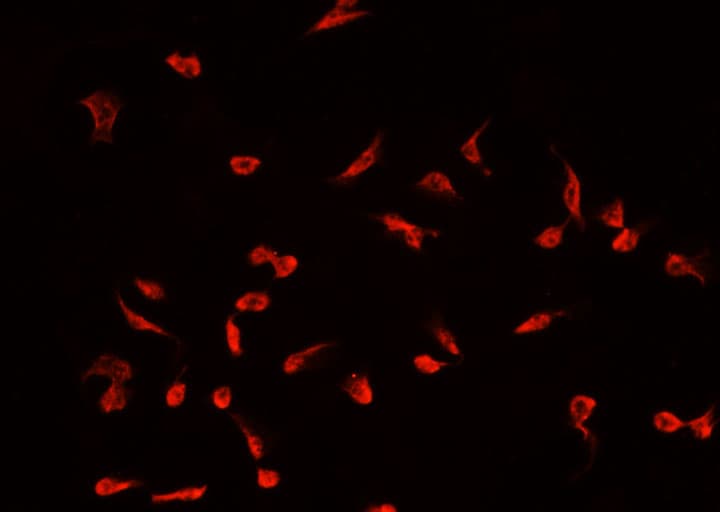 Polyclonal Rabbit anti-Human SAE1 Antibody (IF, WB)