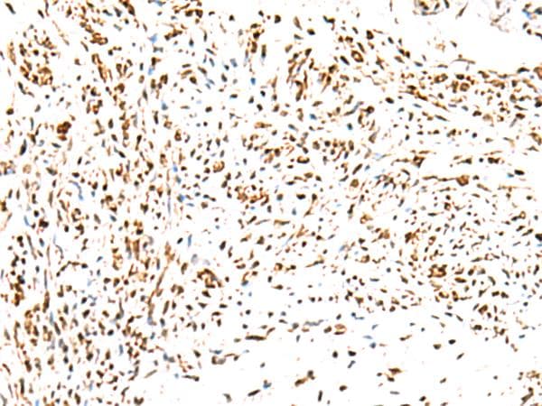 KCTD13 Antibody