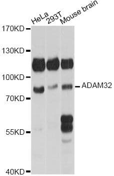 Polyclonal Rabbit anti-Human ADAM32 Antibody (WB)