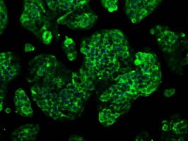 Monoclonal Mouse anti-Human GBE1 Antibody (clone OTI1D11, IHC, IF, WB)