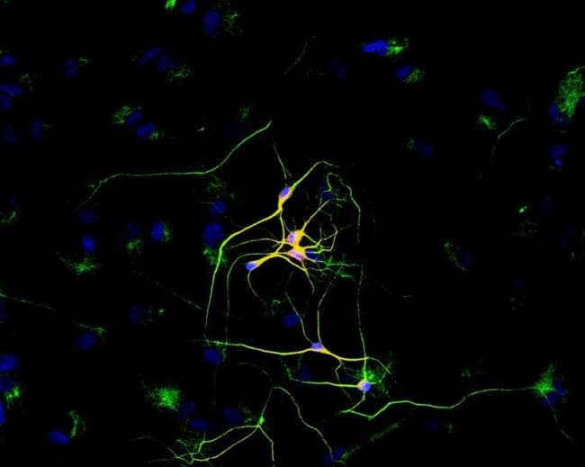 Monoclonal Mouse anti-Human TUBB3 / Tubulin Beta 3 Antibody (clone TU-20, FITC, Amino Acid: 441-448)