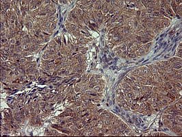 POMC / Proopiomelanocortin Antibody (clone OTI1F3)